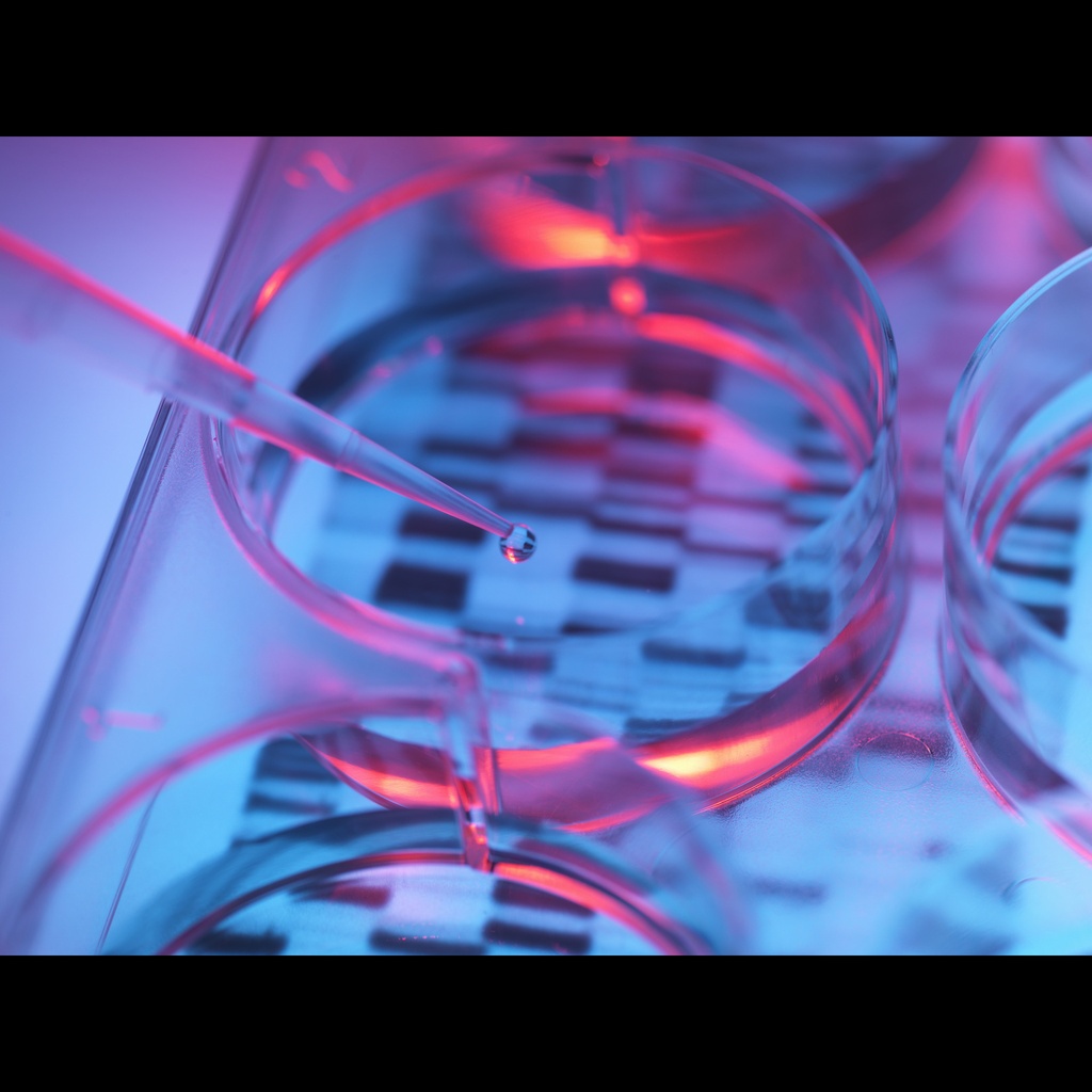 HEK293 Host Cell DNA Residue Detection Kit (2G) -100 T