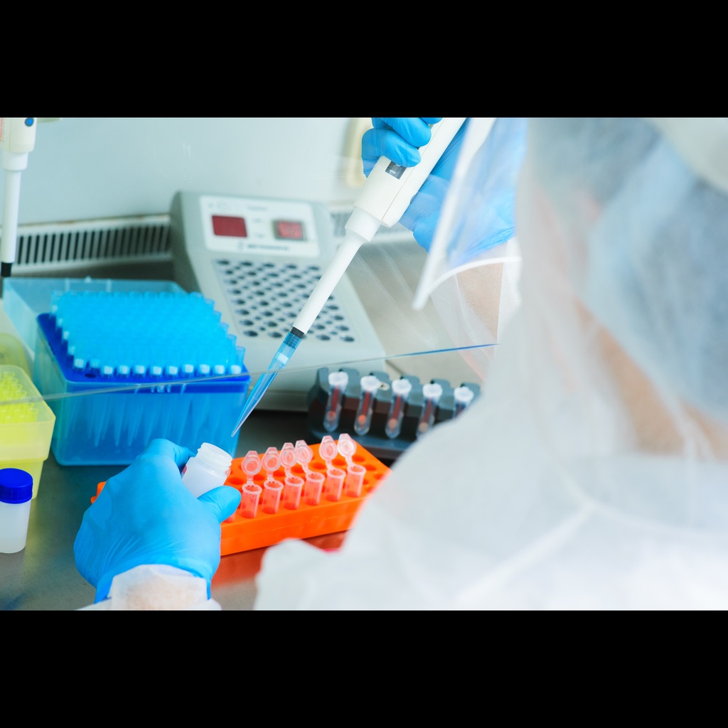 Measles Virus and Rubella Virus Real Time RTsize:PCR Kit size: 25 reactions