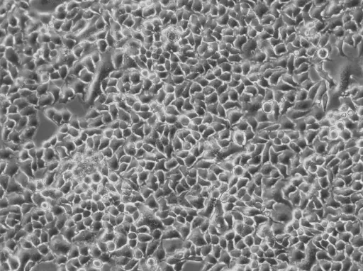 [GEN300986-MA] NS3-CMPK-hLBR1TM-mEGFP Cells